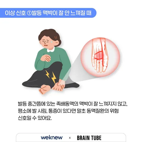 혈관이 막히는 이상 신호 3가지 3장. 이상 신호 ①발등 맥박이 잘 안 느껴질 때. 발등 중간쯤에 있는 족배동맥의 맥박이 잘 느껴지지 않고, 평소에 발 시림, 통증이 있다면 말초 동맥질환의 위험 신호일 수 있어요.