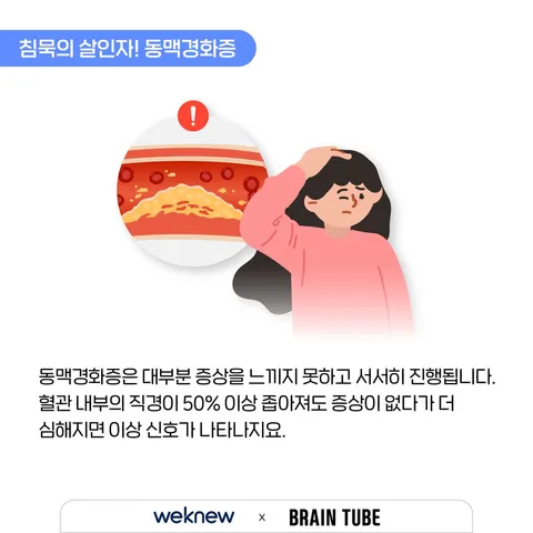 혈관이 막히는 이상 신호 3가지 2장. 침묵의 살인자! 동맥경화증. 동맥경화증은 대부분 증상을 느끼지 못하고 서서히 진행됩니다. 혈관 내부의 직경이 50% 이상 좁아져도 증상이 없다가 더 심해지면 이상 신호가 나타나지요.