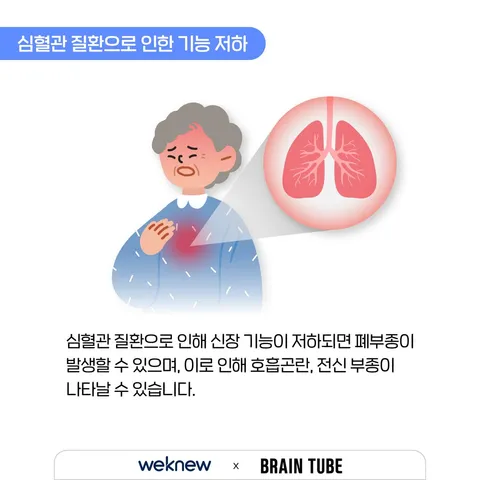 혈관이 막히는 이상 신호 3가지 8장. 심혈관 질환으로 인한 기능 저하. 심혈관 질환으로 인해 신장 기능이 저하되면 폐부종이 발생할 수 있으며, 이로 인해 호흡곤란, 전신 부종이 나타날 수 있습니다.