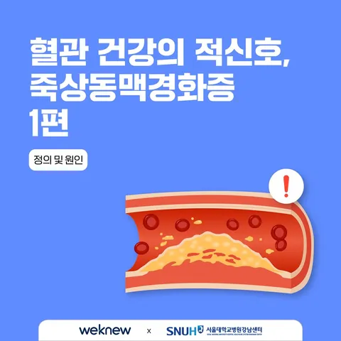 혈관 건강의 적신호, 죽상동맥경화증 1편 1장. 혈관 건강의 적신호, 죽상동맥경화증 1편 (정의 및 원인)